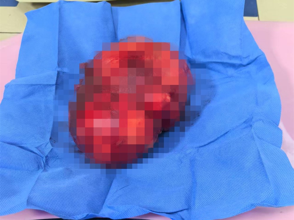 fd911fd4f616595d36f1215cfc80e5d_副本.jpg