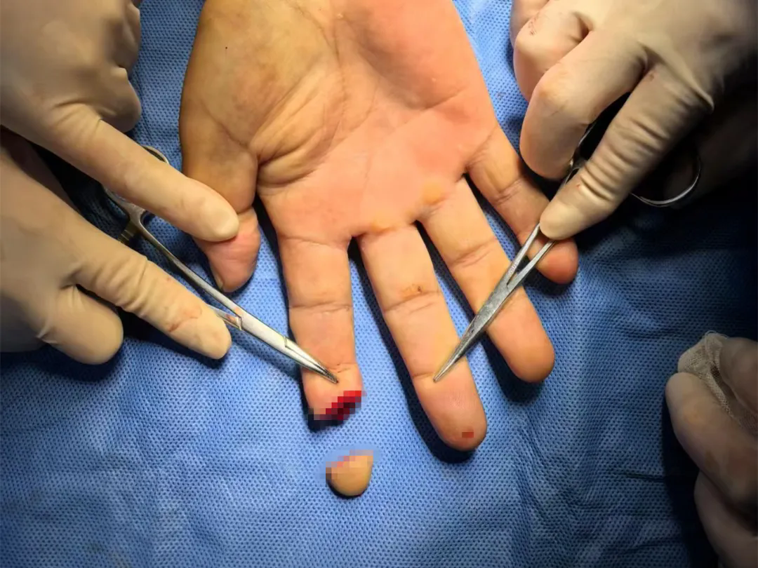 640_wx_fmt=jpeg&from=appmsg&tp=webp&wxfrom=10005&wx_lazy=1.webp (1).png